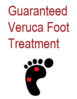 Veruca Foot Treatment