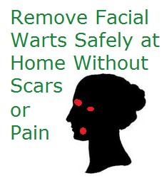 Facial Warts