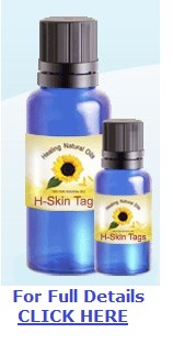 H-Skin Tags More Info