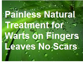 Warts on Fingers Treatment