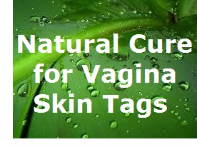 vaginal skin tags on lip