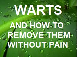 Warts